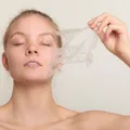 Chemical Peel