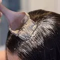 Root Touch-up