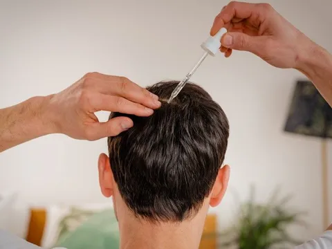 Hair Nutrition Therapy