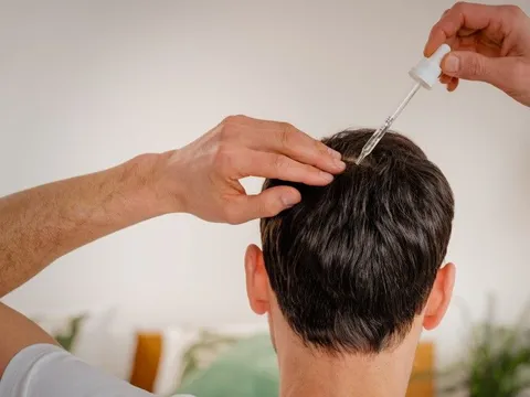 Hair Nutrition Therapy