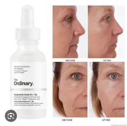 The ordinery Hyarulonic acid 2%+B5 serum 30ml