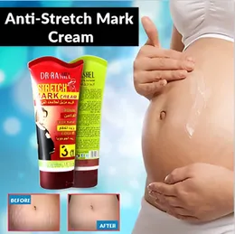 Dr. Rashel Stretch Mark Cream Cocoa Butter, 150g