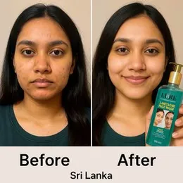 LURE Anti Acne Face Wash 100ml