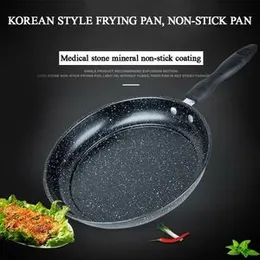 Fry Pan Marble Coated Nonstick Frypan