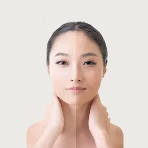 Anti Tan Facial