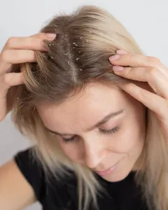 Chronic Itchy Scalp Management